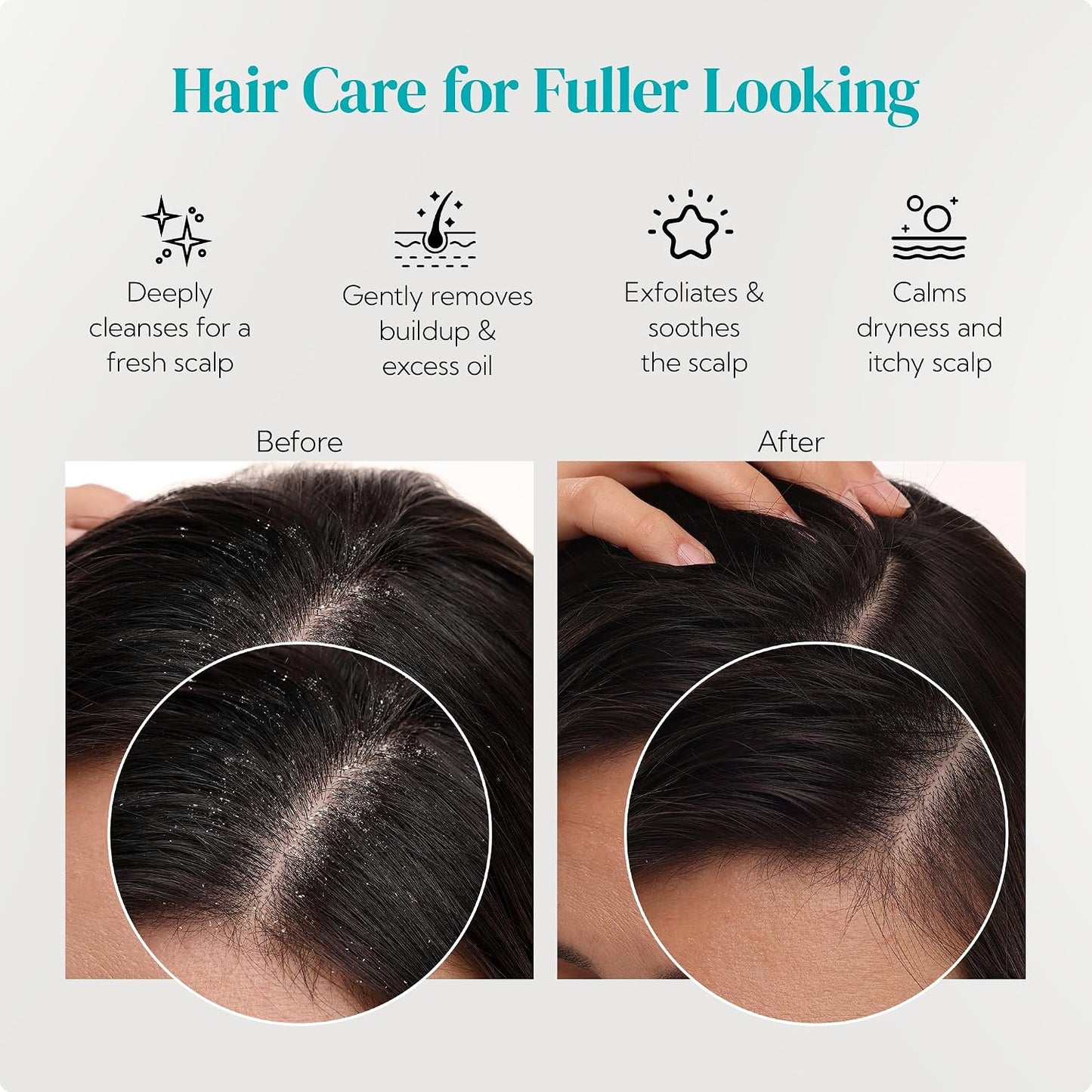Gentle Hair Scalp Massager Duo